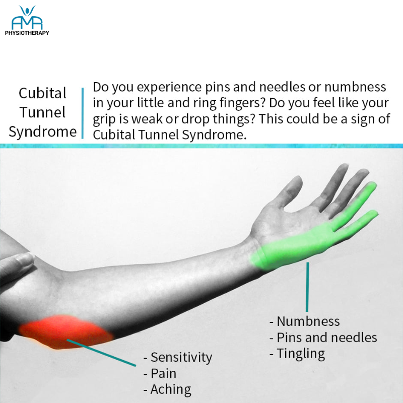 symptoms of cubital syndrome