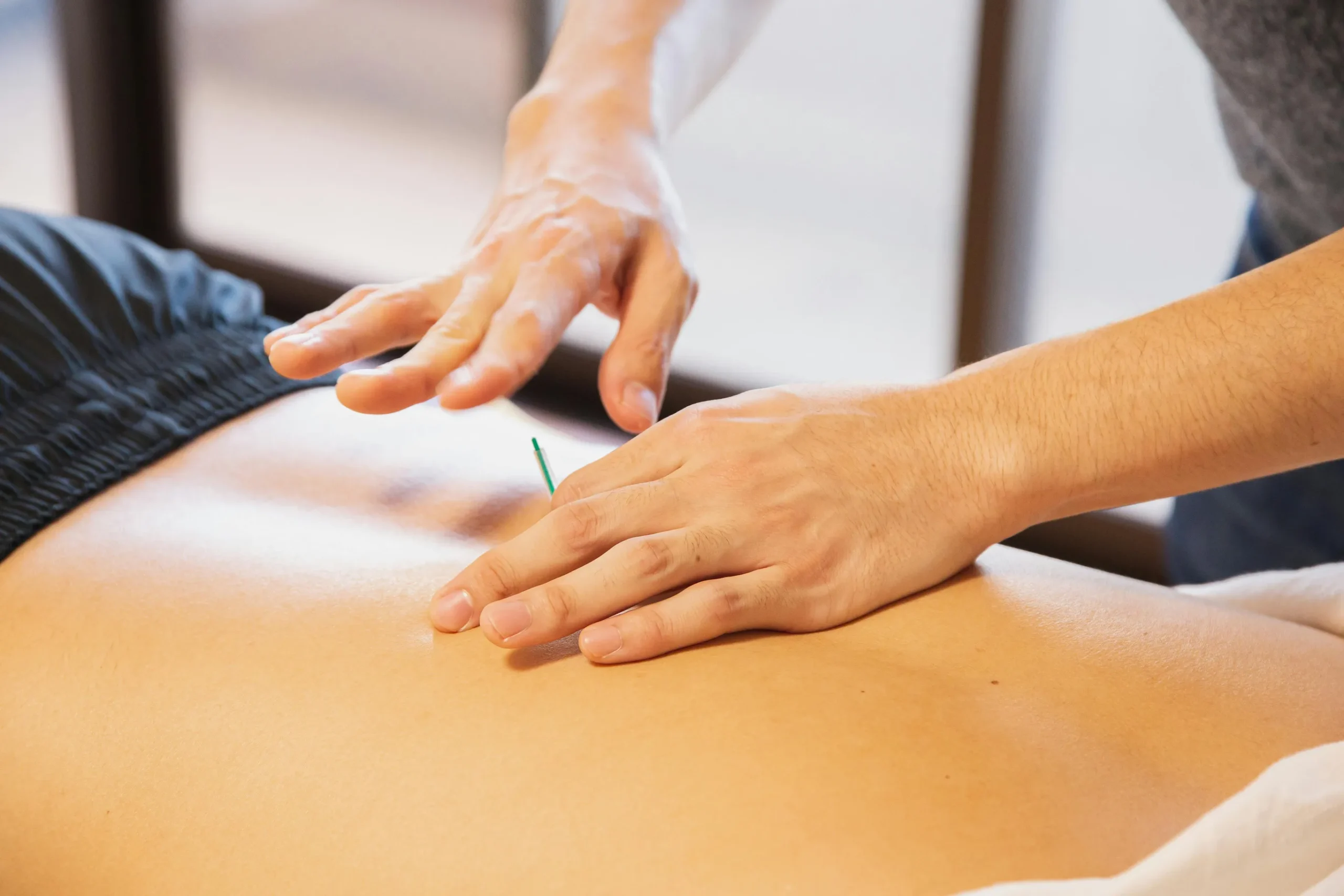 Dry Needling - AMR Physiotherapy