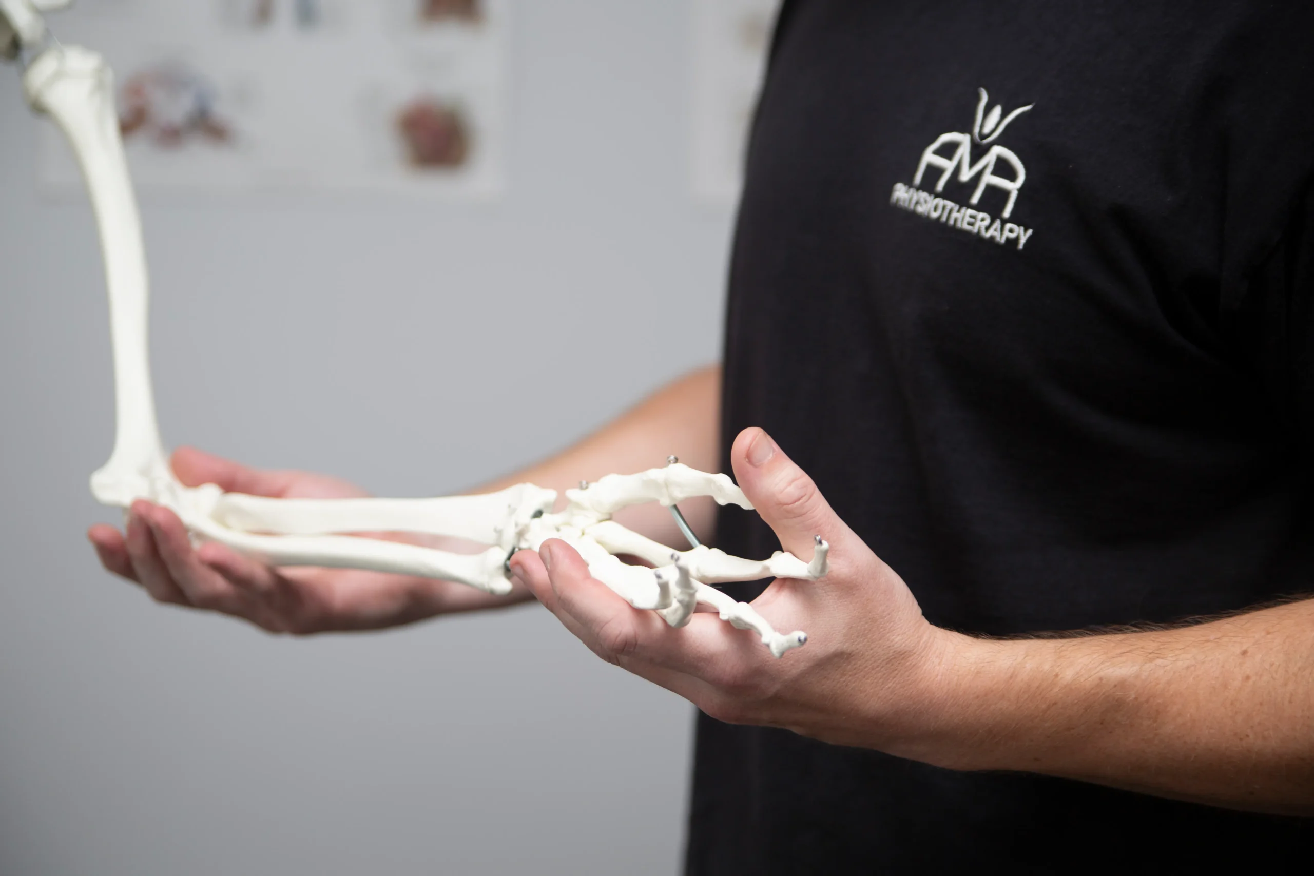 Hand Therapy - AMR Physiotherapy