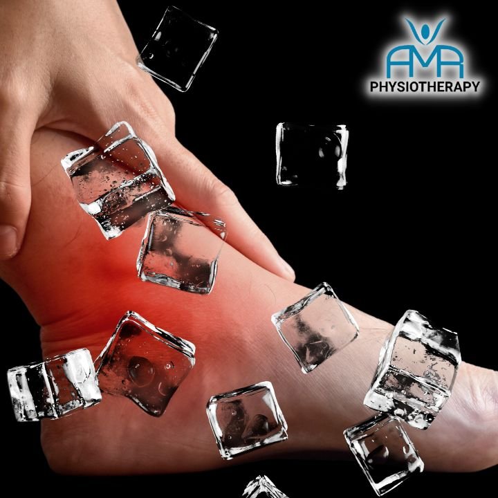 Do you ice an injury